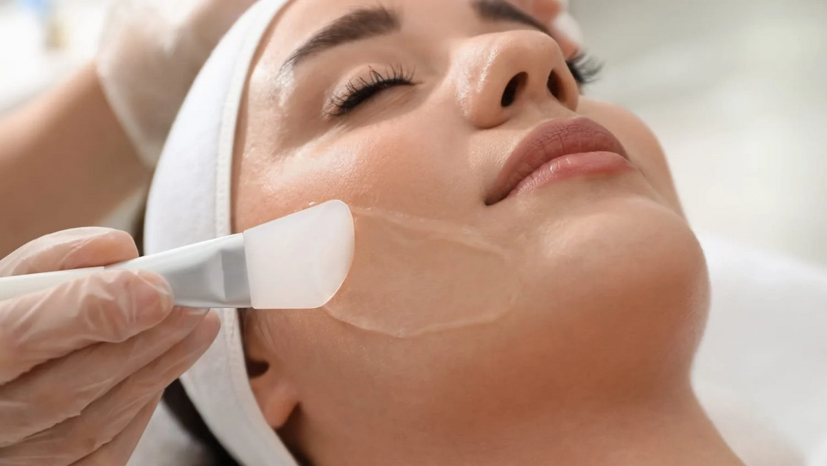 Chemical Peel Las Vegas Henderson NV