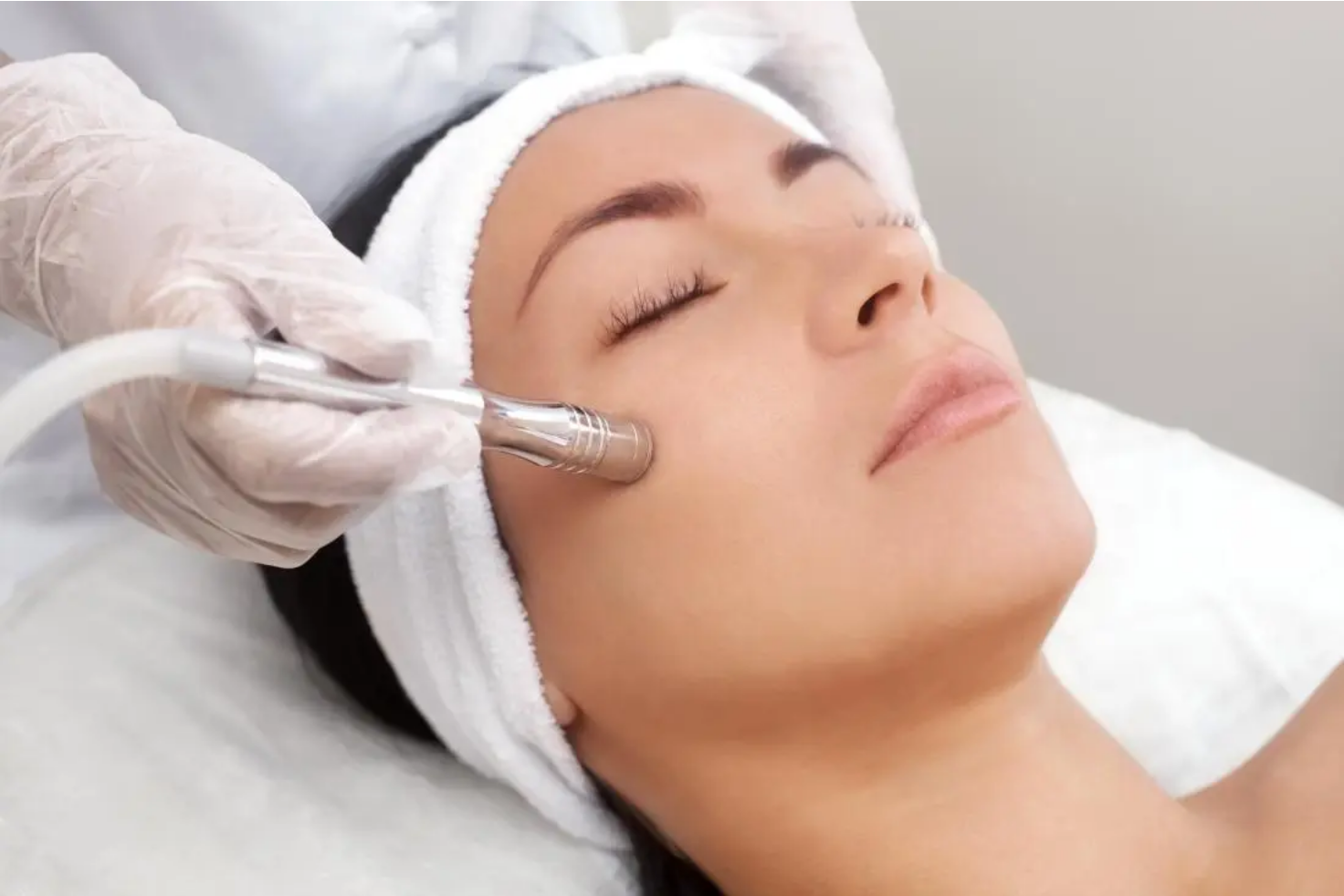 Microneedling Las Vegas Henderson NV